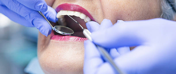 Emergency Dental Filling Replacement in MN